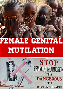 FGM