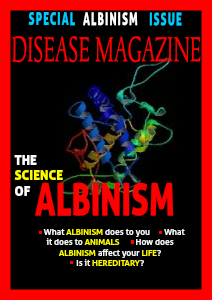 Albinism April 29, 2013