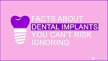 Facts About Dental Implants You Can’t Risk Ignoring