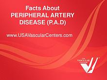 Facts About Peripheral Artery Disease (P.A.D)