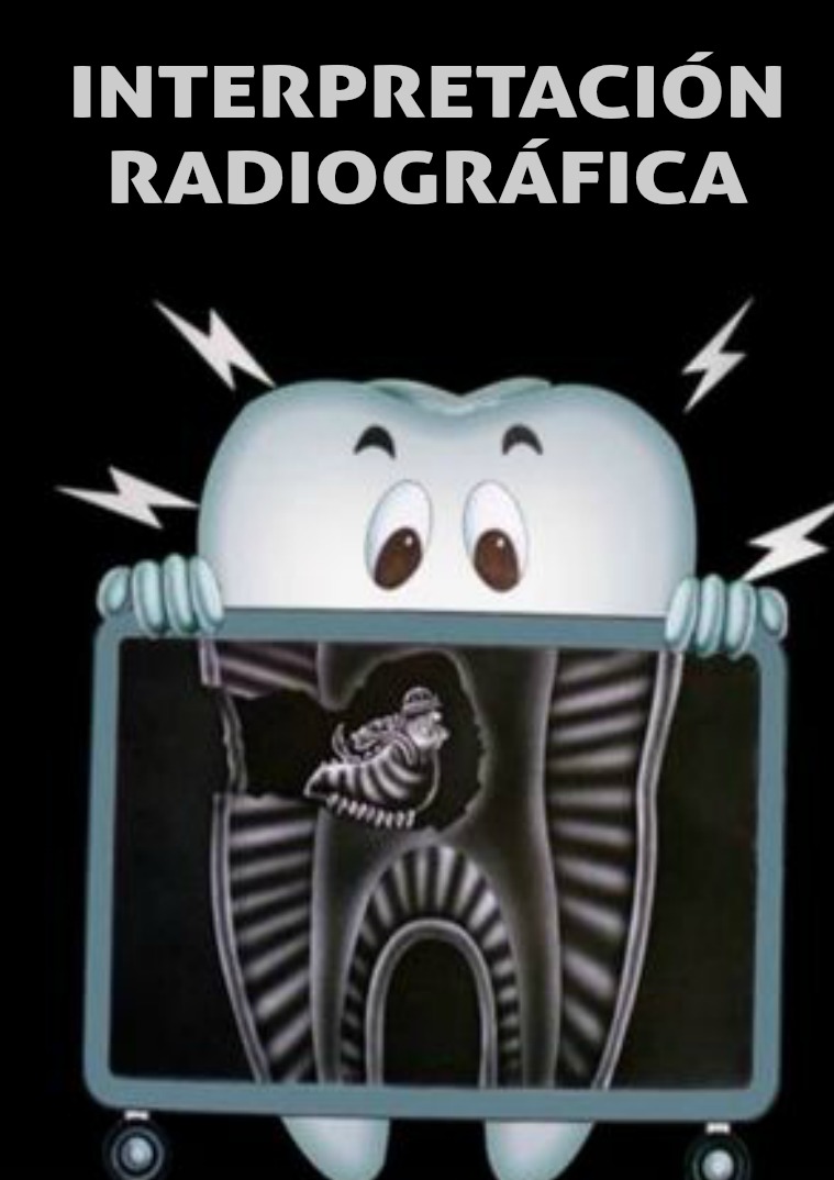 INTERPRETACIÓN RADIOGRÁFICA 1