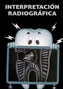 INTERPRETACIÓN RADIOGRÁFICA