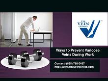 Ways to Prevent Varicose Veins During Work